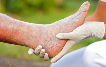 Aged Care