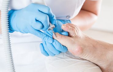 Fungal Nails & Skin