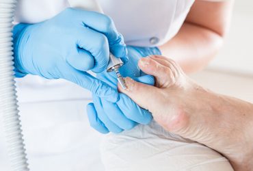 Fungal Nails & Skin